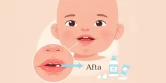 ilustração estilo infográfico de um bebê com afta