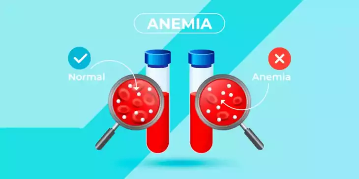 Infográfico mostrando nível celular de uma pessoa normal e com anemia